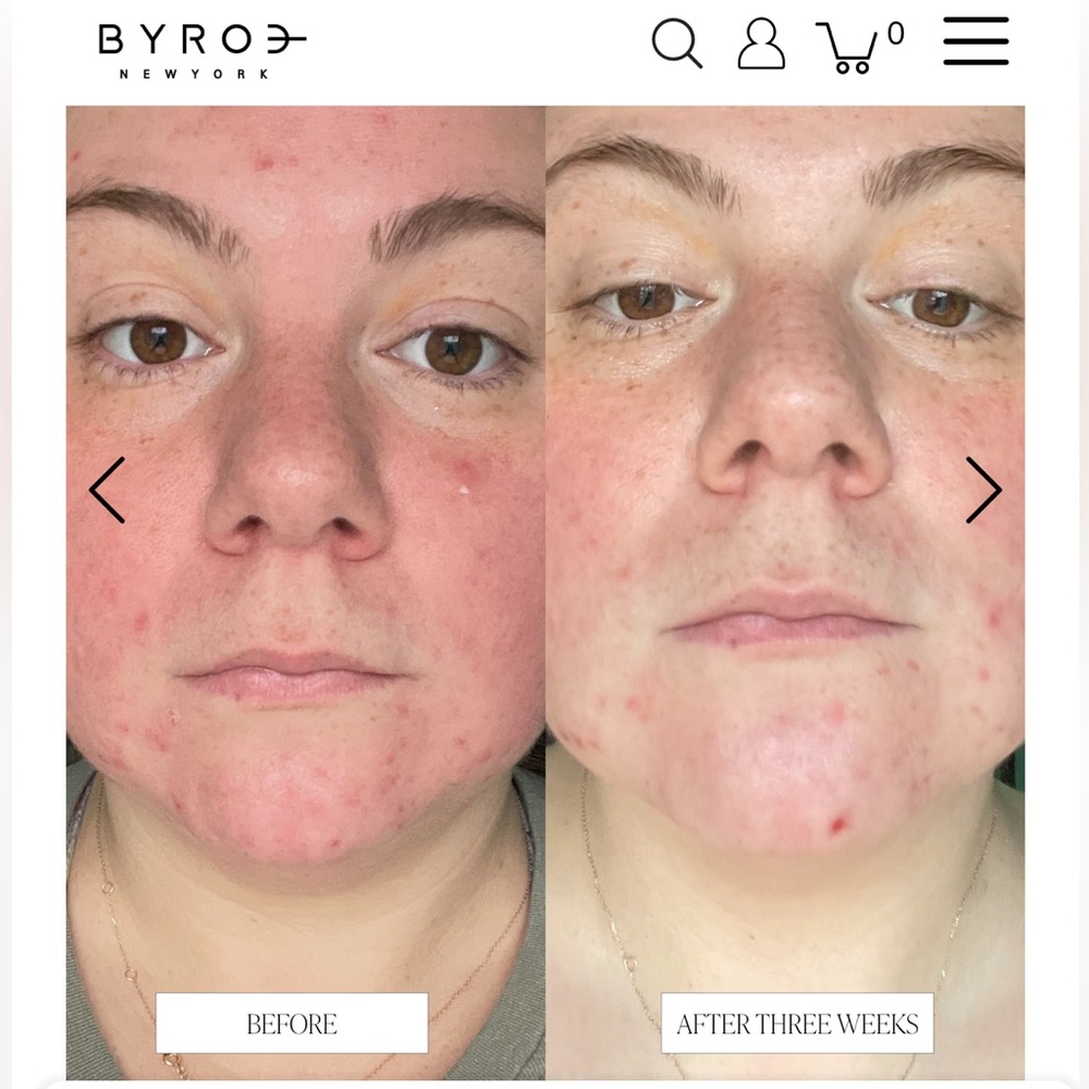 Byroe Celery AHA + LHA Resurfacing Serum Brand New in Box - Picture 5 of 11